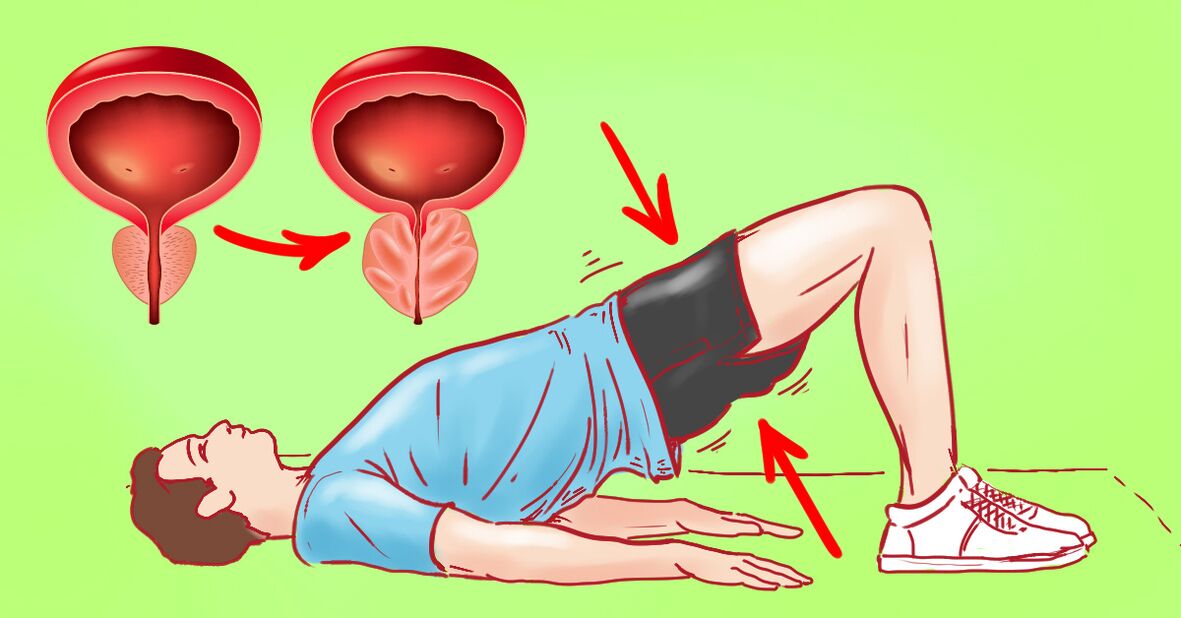 Kronik prostatit için terapötik egzersizler