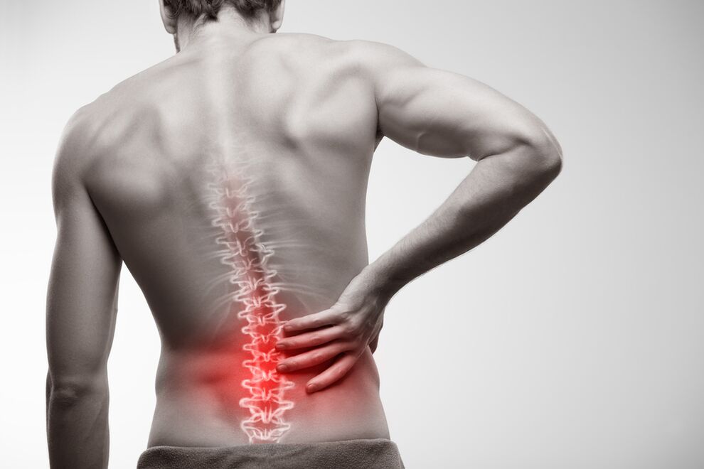 Sacrum'da ağrıyan ağrı - kronik prostatitin bir işareti
