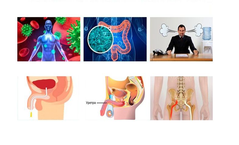 prostatit nedenleri