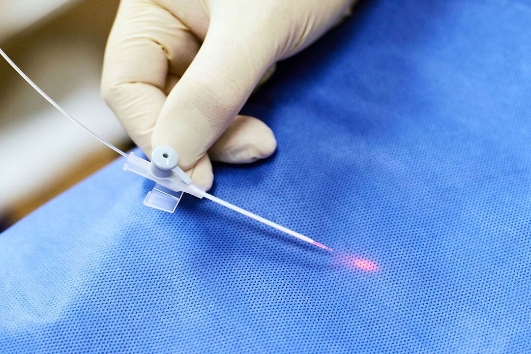 prostat tedavisi için transrektal cihaz